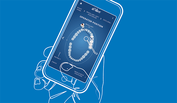 Angles of Access dental ergonomics app